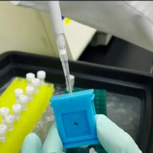 GW Researchers Develop Test to Predict How Sick People Will Get From COVID | NBC4 Washington