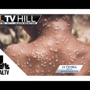 11 TV Hill: What exactly is monkeypox? How is it spread?