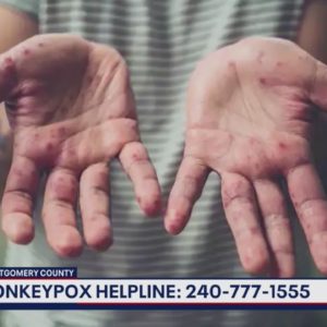 Montgomery Co. holds first monkeypox town hall